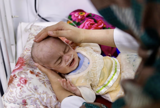 الأمم المتحدة: مئات الآلاف من الأطفال في أفغانستان يواجهون خطر الموت