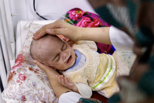 الأمم المتحدة: مئات الآلاف من الأطفال في أفغانستان يواجهون خطر الموت