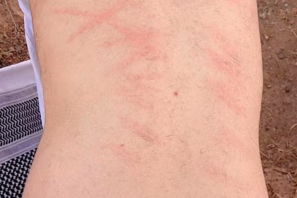 فراتر از ۱۰۷ هزار شلاق طالبان بر تن انسان افغانستان