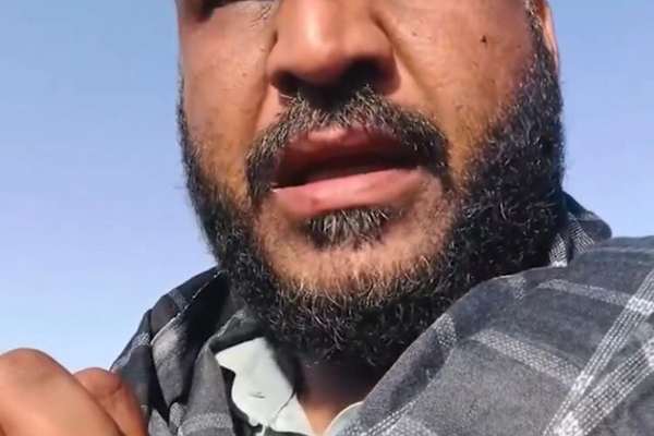 افغان سینماګر: د زوی د درملنې وس نه لرم چمتو یم د درملنې په بدل یې بل چا ته وسپارم