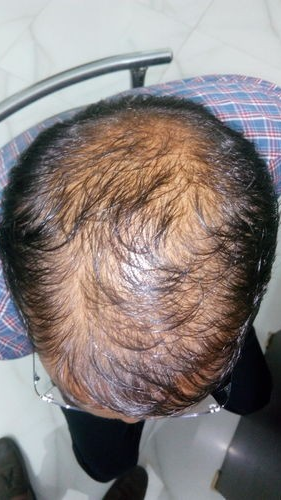 ولې مو وېښته توییږي او څنګه یې مخه ونیسو؟