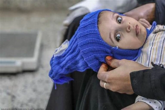 د روغتیا نړۍوال سازمان: د افغانستان ماشومان راتلونکی ژمی د ساري ناروغیو له ګواښ سره مخ دي